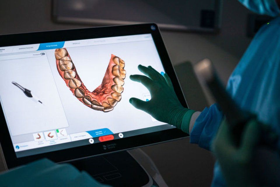 modello 3d di arcata dentale