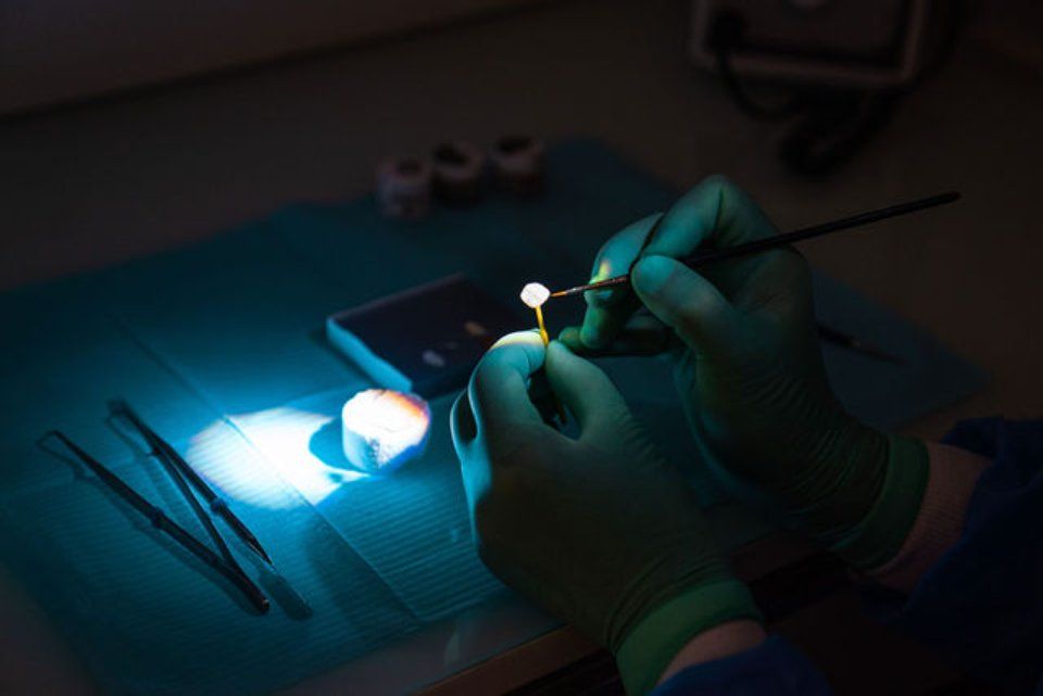 realizzazione protesi