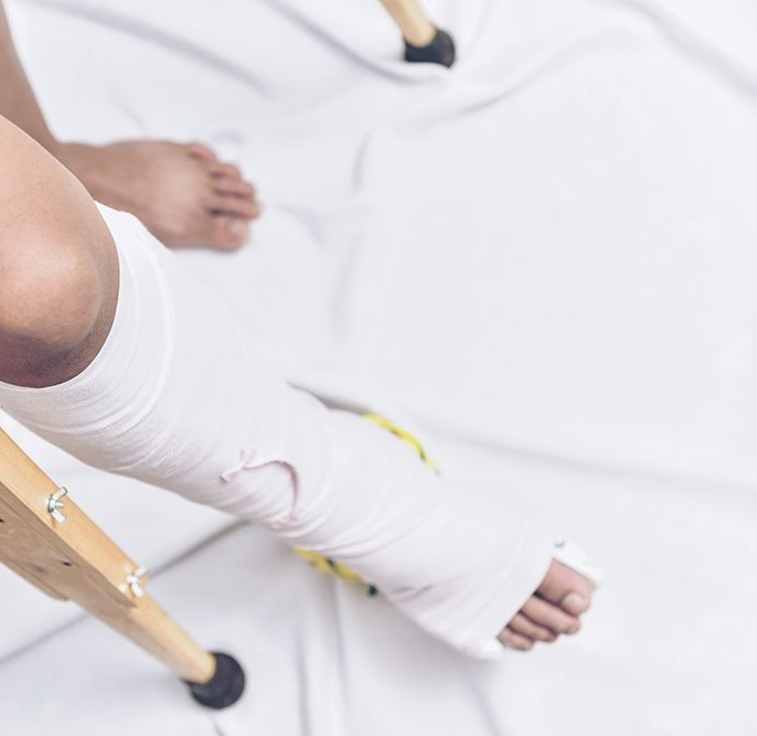 Metatarsal Stress Fracture