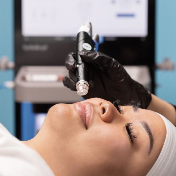 Woman receiving a skin treatment, lying down. Black-gloved hand holds a device near her face. Bright blue background.