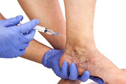 Dr Flora Skin Health Sclerotherapy