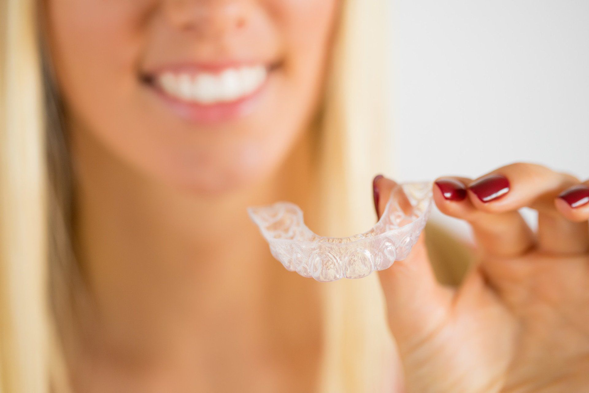 Invisalign clear aligners