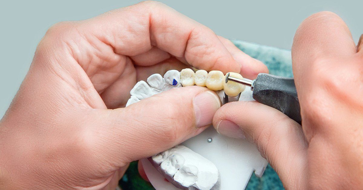 how long do teeth implants last