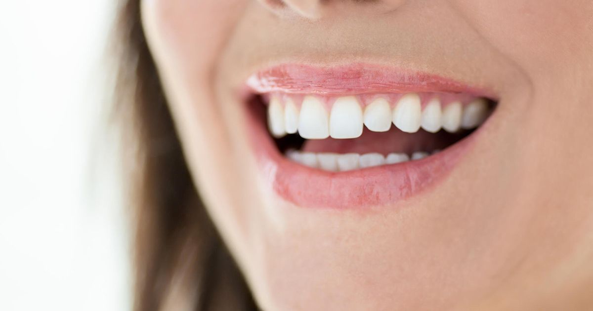 A close up of a woman 's teeth with her mouth open.