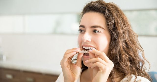 What to Know Before Starting Invisalign Treatment