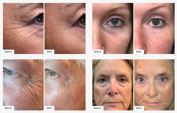 Age IQ® Eye Serum — Corona, CA — Vikki & John Downey
