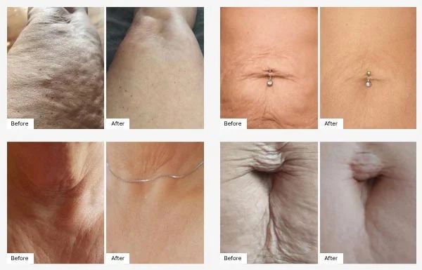 Firm Body Contour Cream — Corona, CA — Vikki & John Downey
