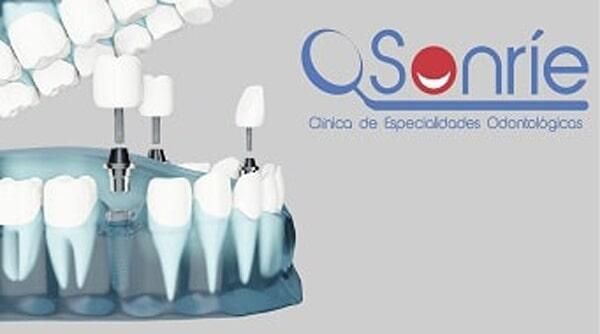 SONRIE CLÍNICA DE ESPECIALIDADES ODONTOLÓGICAS