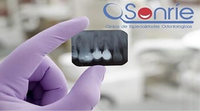SONRIE CLÍNICA DE ESPECIALIDADES ODONTOLÓGICAS
