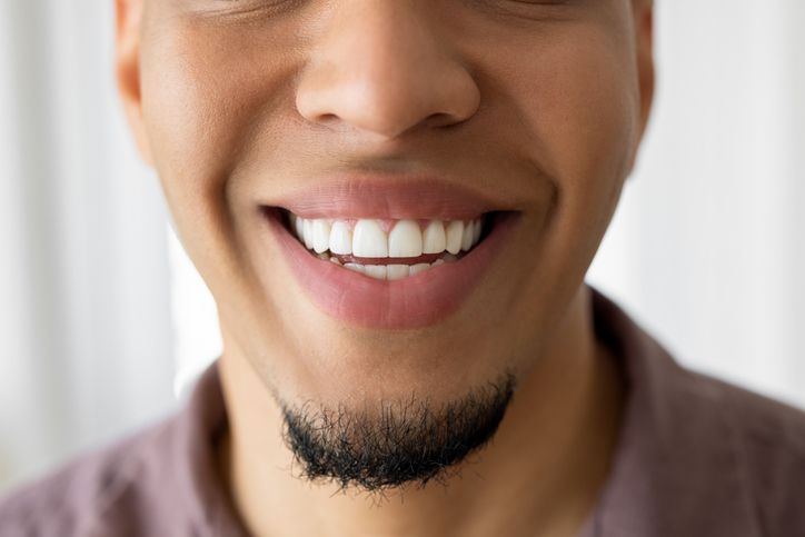 Close-up of a smiling person with white teeth and a neatly trimmed goatee.
