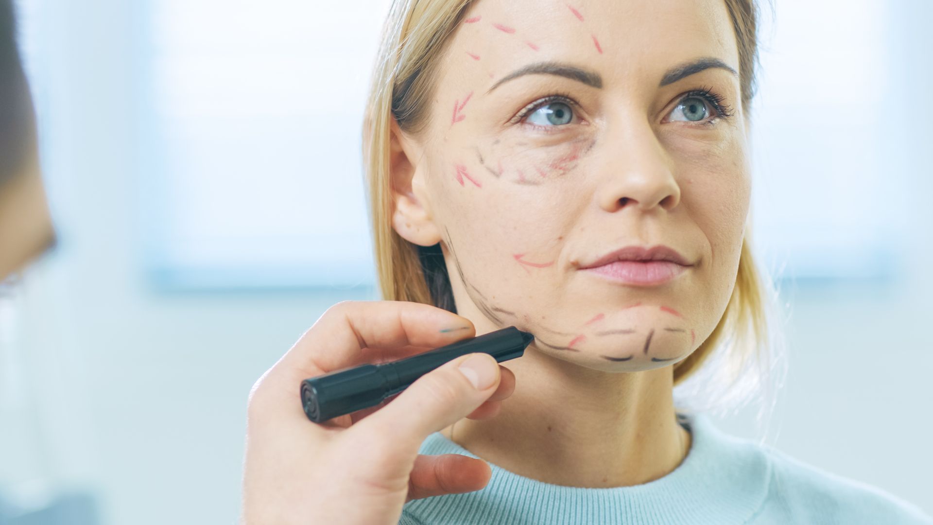 A doctor is marking a woman for a facelift procedure. A doctor is marking a woman for a facelift procedure.