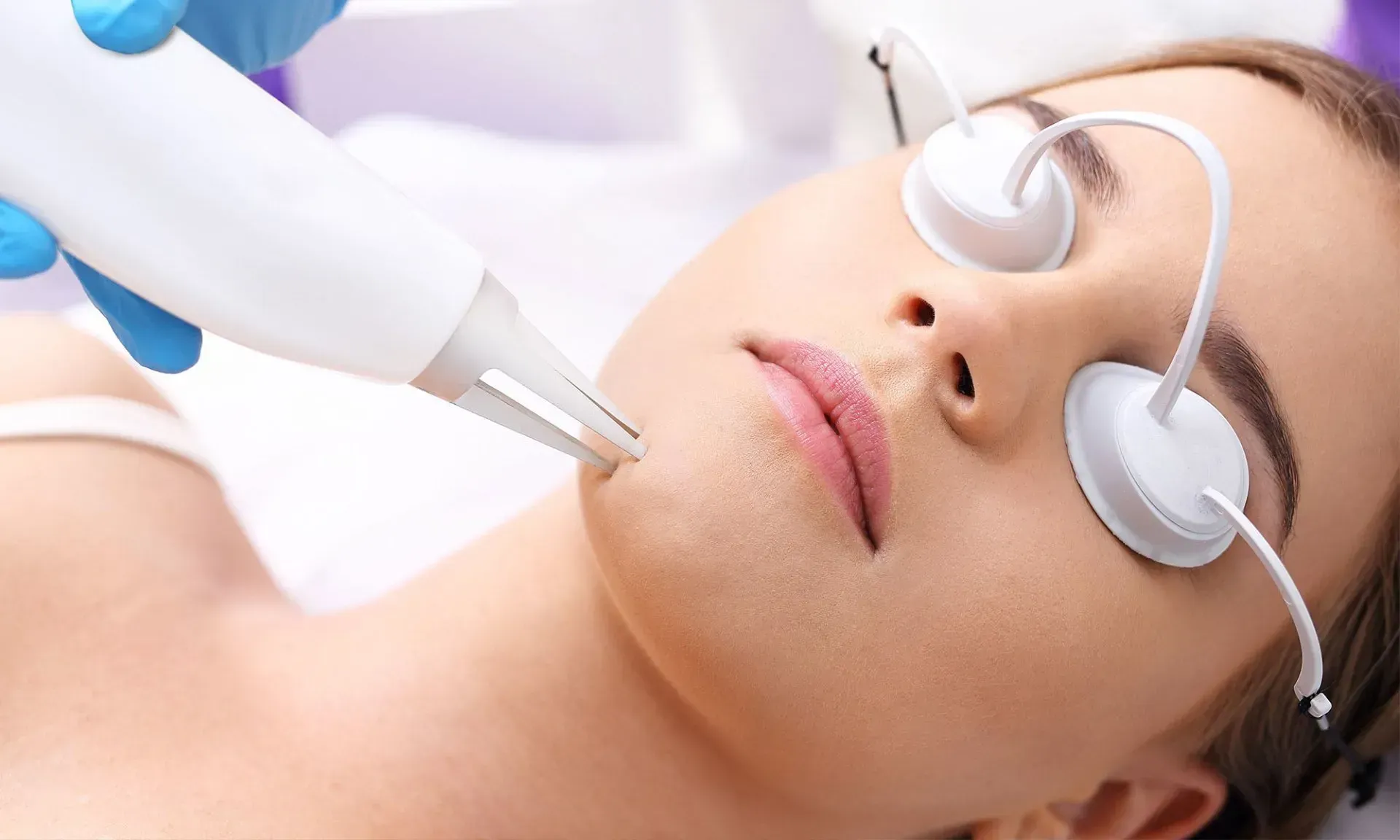 laser treatments