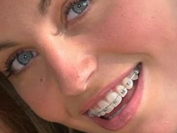 CONSULTORIO DENTAL DE ORTODONCIA