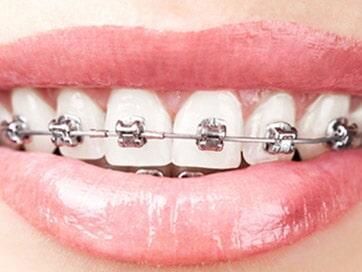 CONSULTORIO DENTAL DE ORTODONCIA