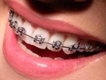 CONSULTORIO DENTAL DE ORTODONCIA