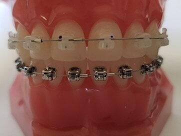 CONSULTORIO DENTAL DE ORTODONCIA