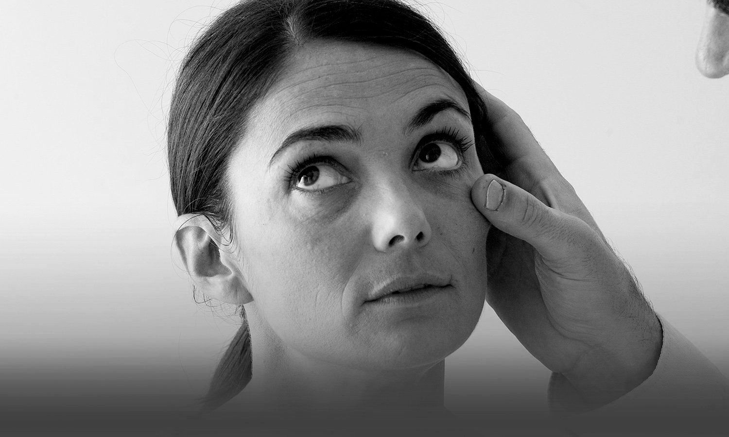 black and white photo of a patient who's  under eye area is being examined by a doctor for blepharoplasty 