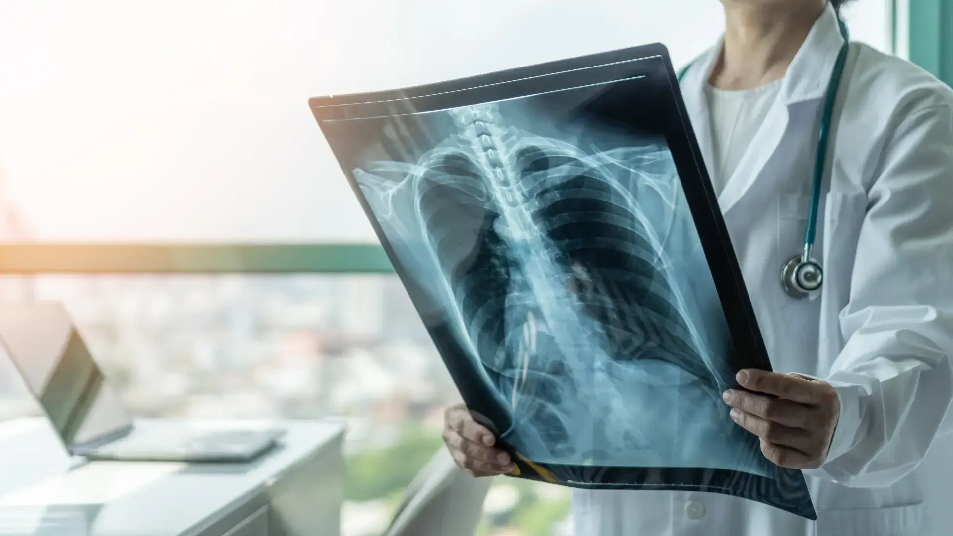 A doctor is holding an x-ray of a person 's lungs.