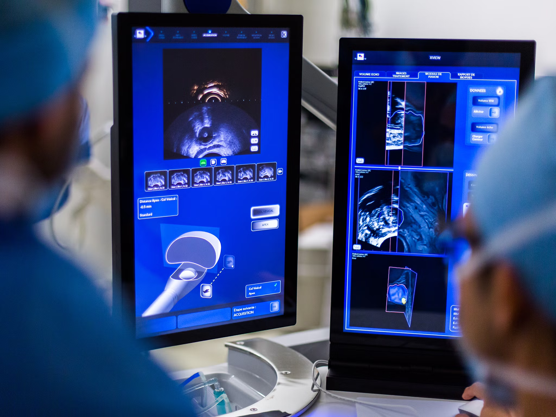 A group of surgeons are looking at a computer screen.