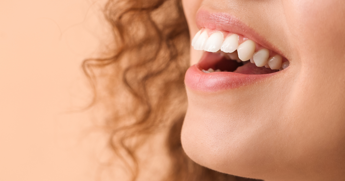 Gros plan sur une personne souriante, montrant des dents blanches, avec des cheveux bouclés visibles à gauche