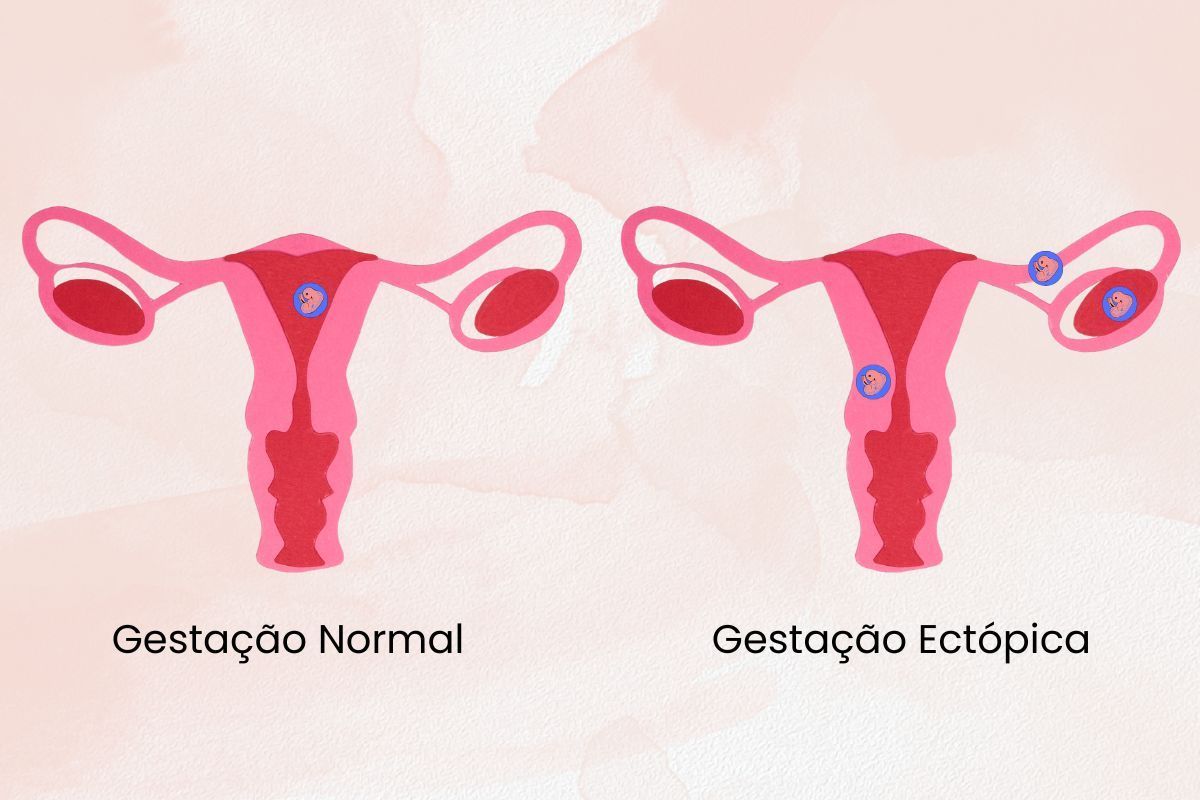 anatomia-gestacao-dra-graziele-cervantes-ginecologista-obtetra-sao-paulo