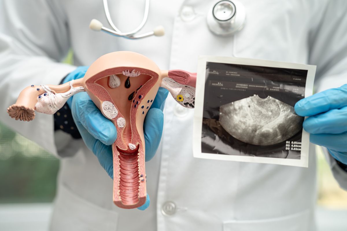 Quais os tipos de malformação uterina - Mulleriana