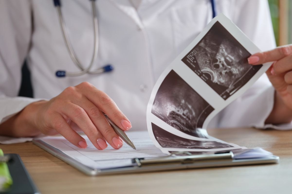 Sangramento em excesso na menstruação pode ser mioma; entenda