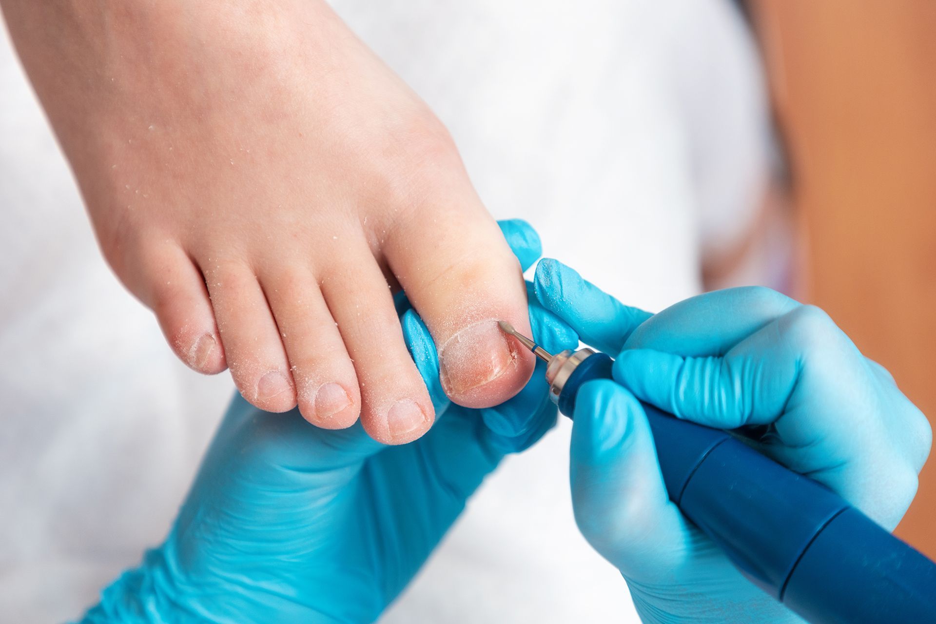 Un médico le está arreglando las uñas de los pies a una persona.