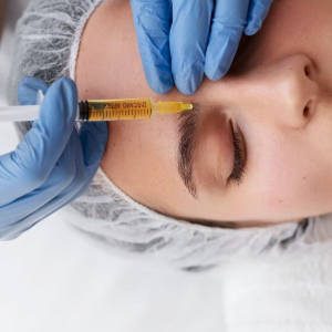 Gloved hands inject yellow liquid into a patient’s eyebrow area with a syringe