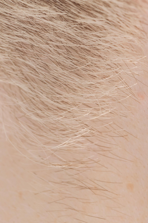 Close-up of light beige fur with fine hair texture and a small pinkish skin patch