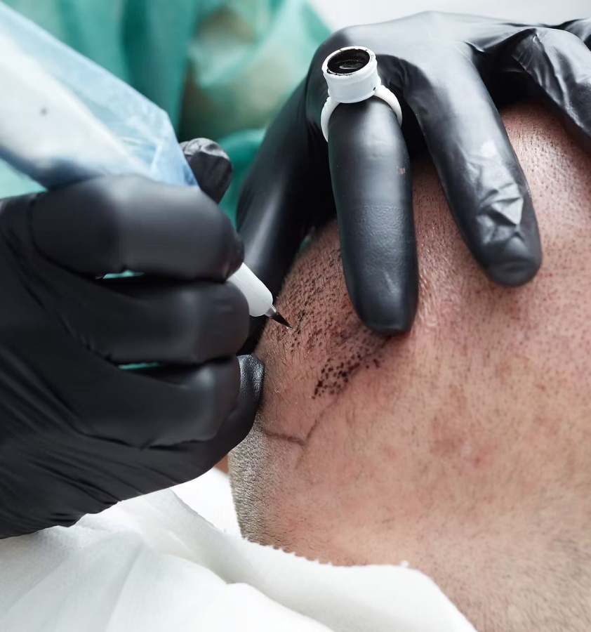 Gloved hands tattooing a person’s shoulder with a needle and ink