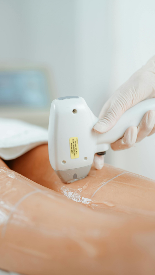 Gloved hand using a handheld device on a person’s bare leg during a cosmetic treatment