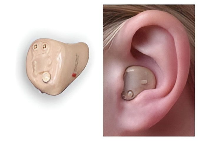 AUDIFONOS PARA SORDERA