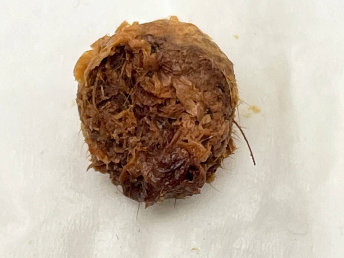 Happy Ears Ear Wax Removal Nottingham close up of a lump of ear wax removed by irrigation