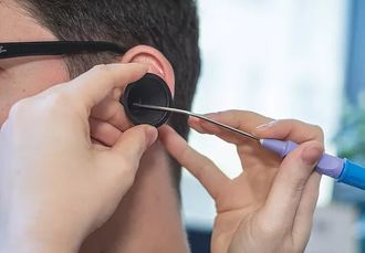earwax microsuction