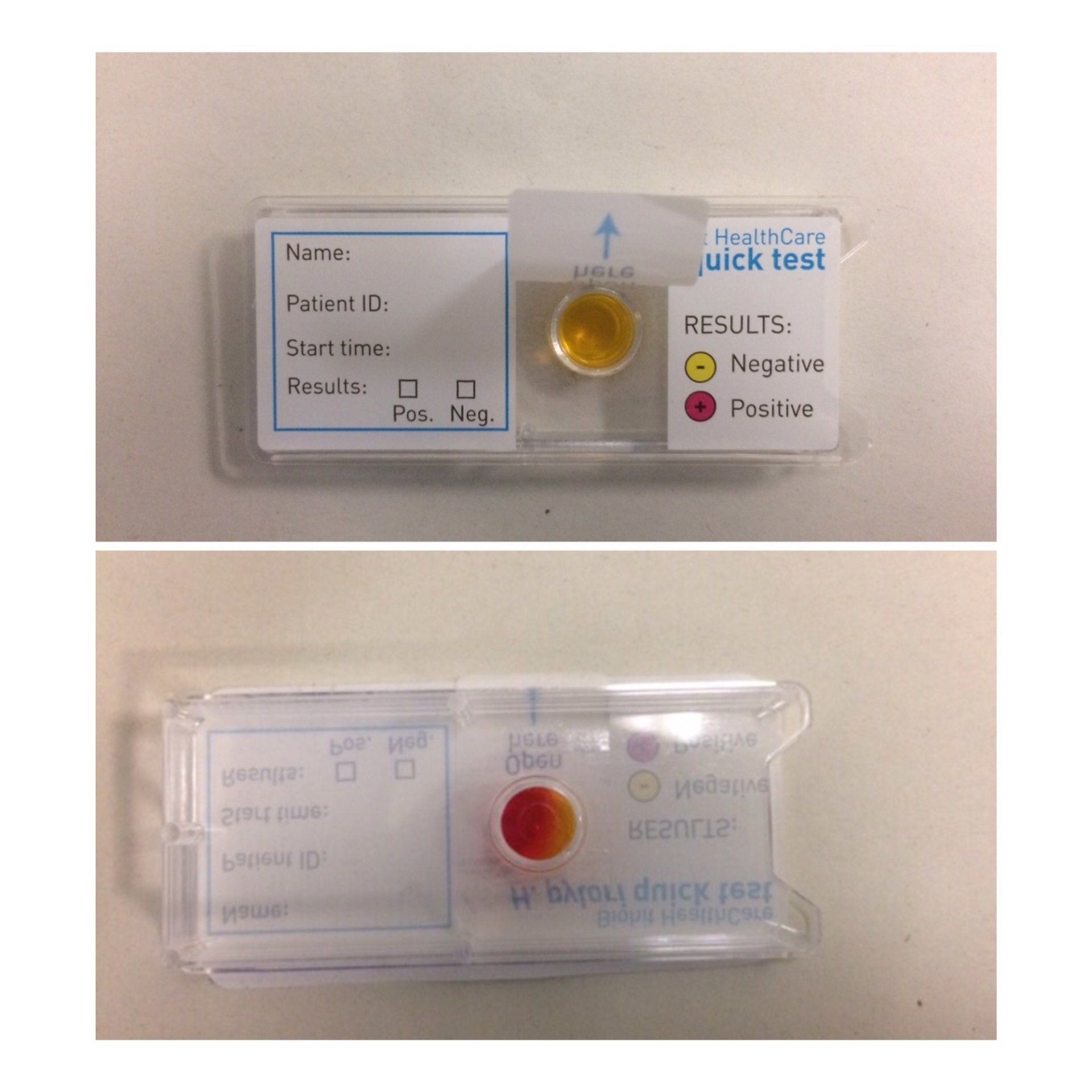 Helicobacter pylori test and other paediatric gastroenterology investigations used in children
