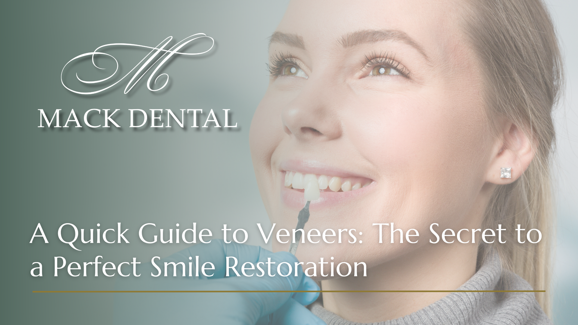 A quick guide to veneers : the secret to a perfect smile restoration