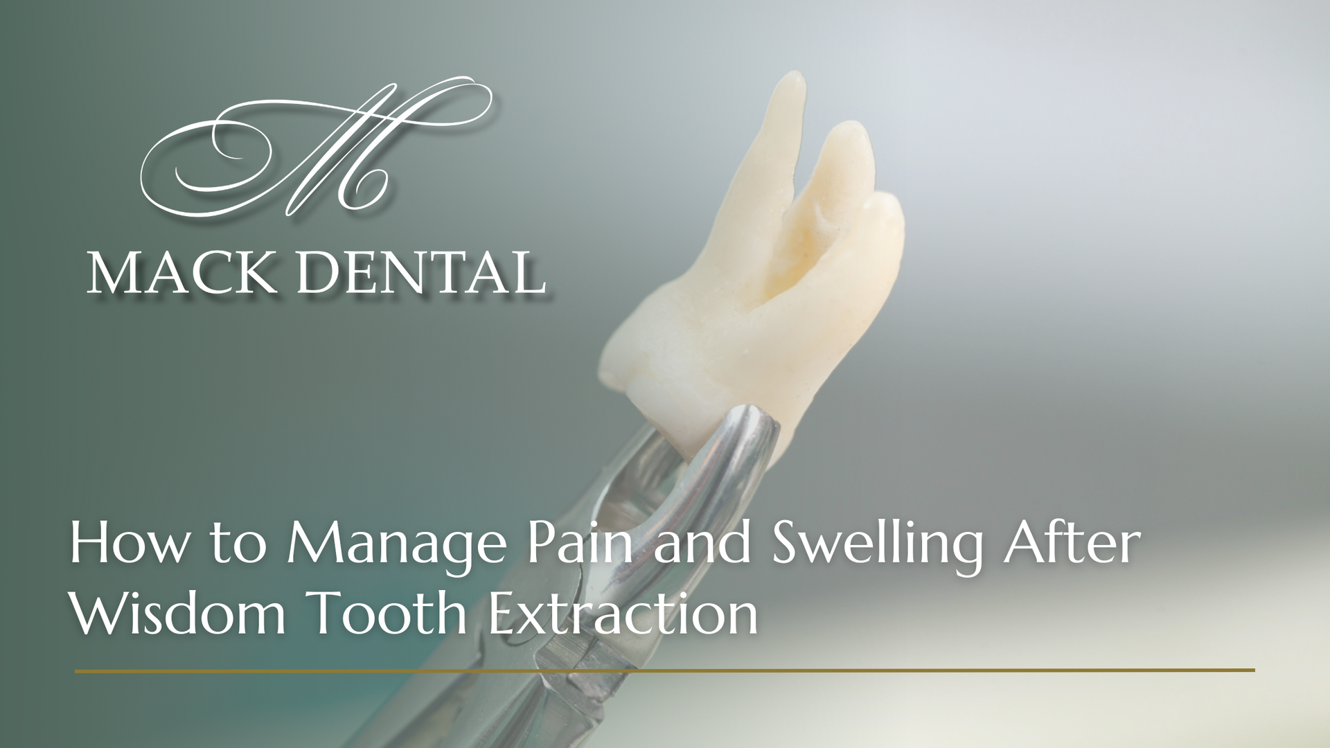 How to manage pain and swelling after wisdom tooth extraction