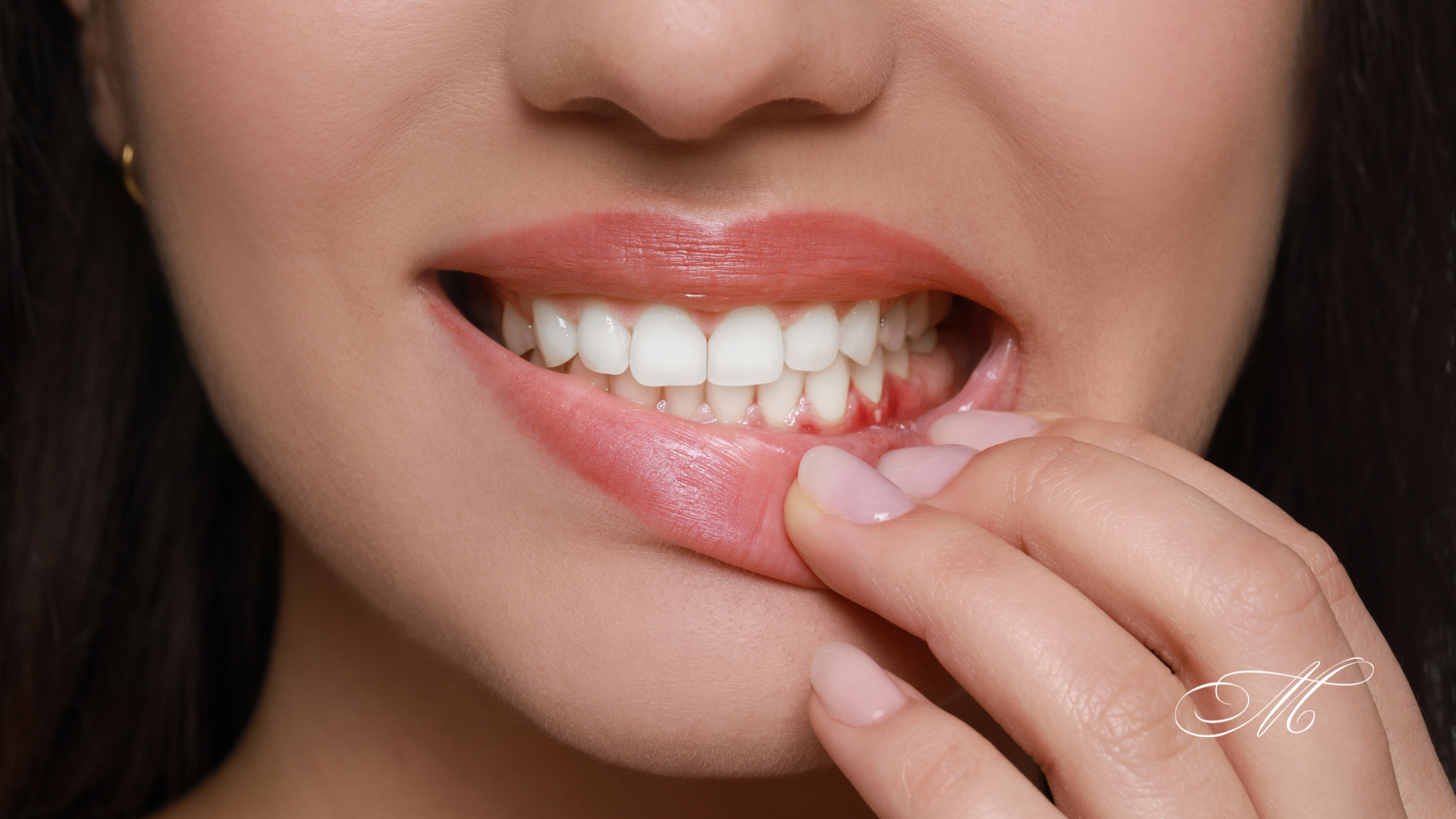 A close up of a woman 's mouth with her hand on her teeth.