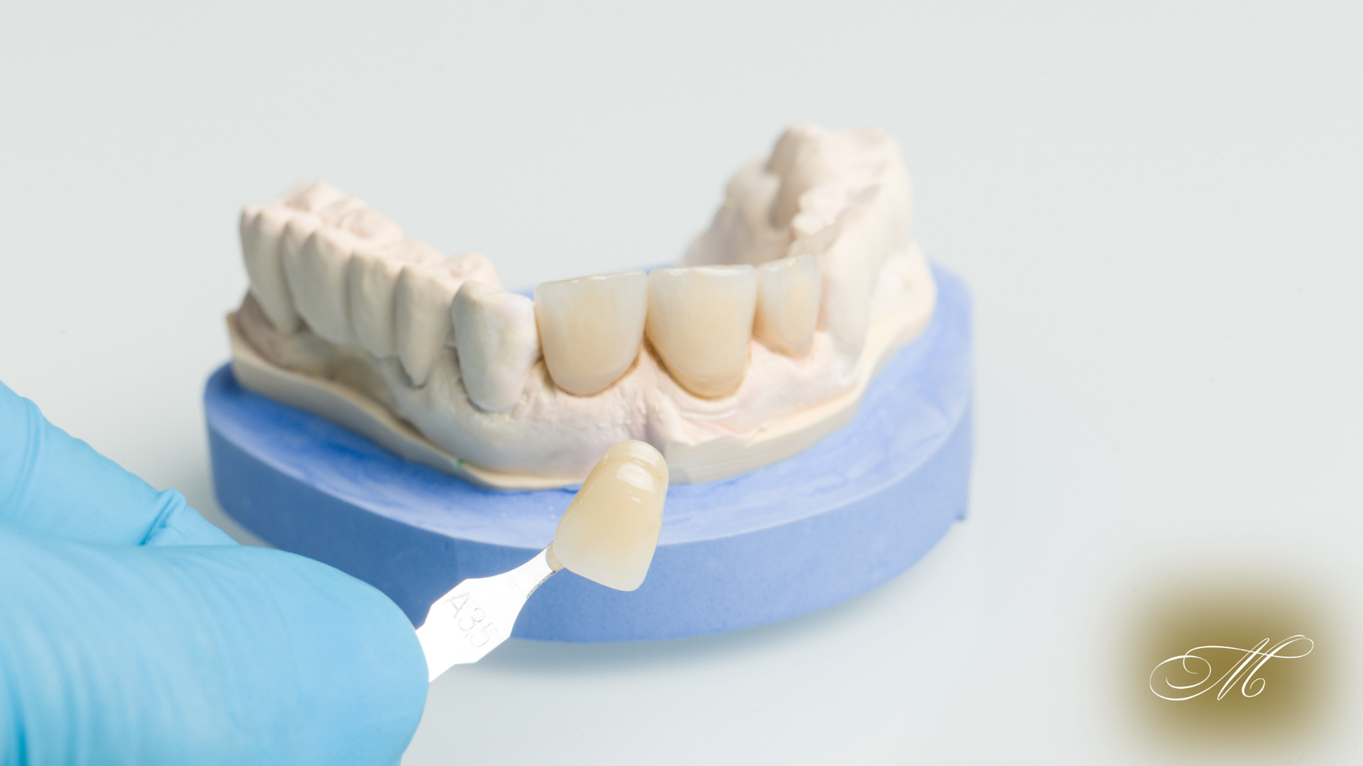 A model of a person 's teeth with a dental crown on it