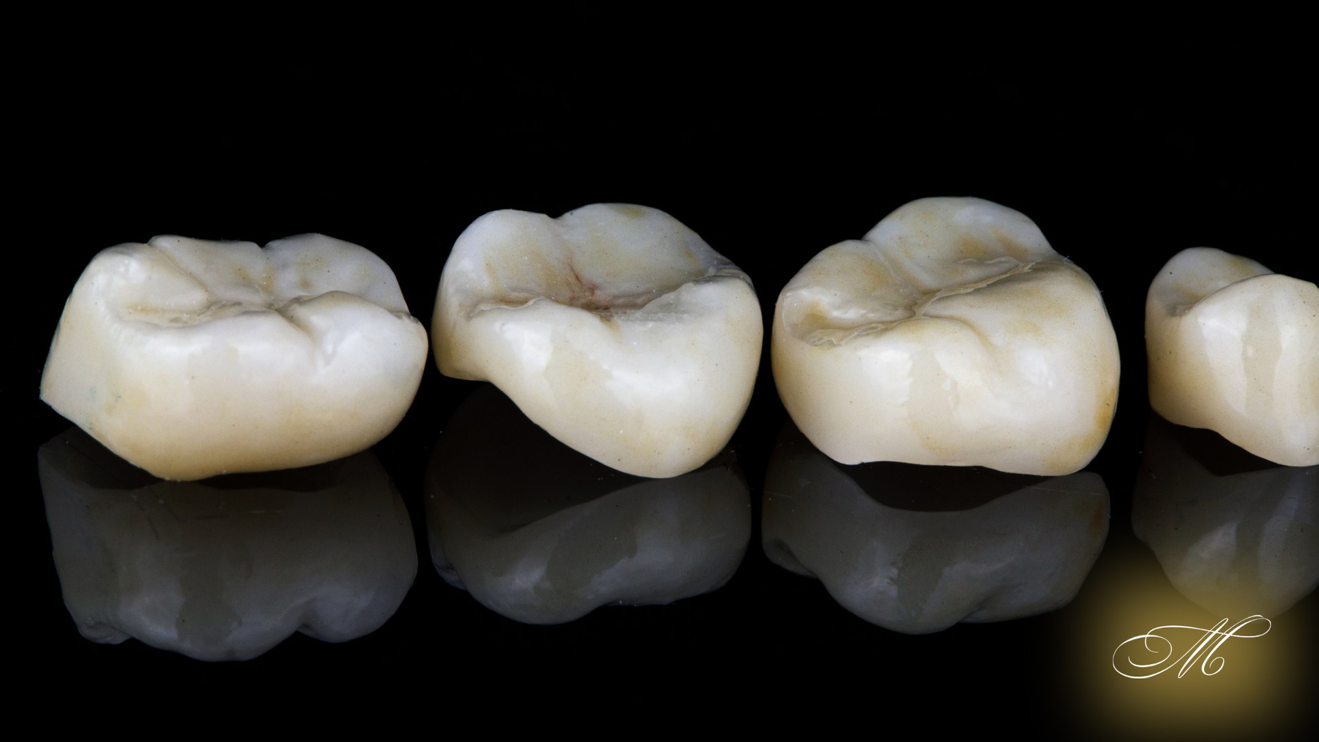 Four dental crowns, cream-colored with dark grooves, reflected on a black surface.