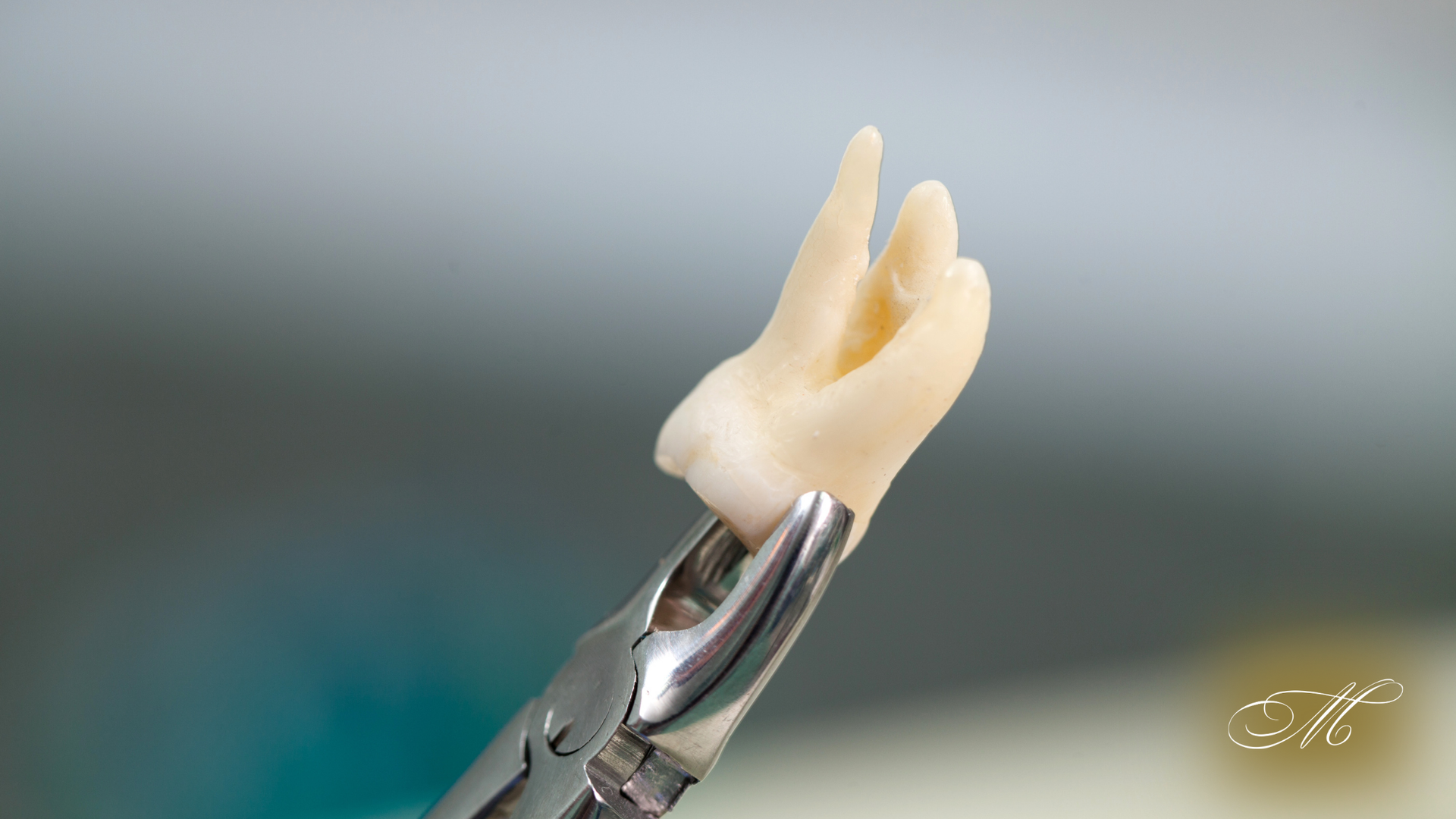 Tooth held in dental forceps. Creamy white tooth with several roots against a blurry background.