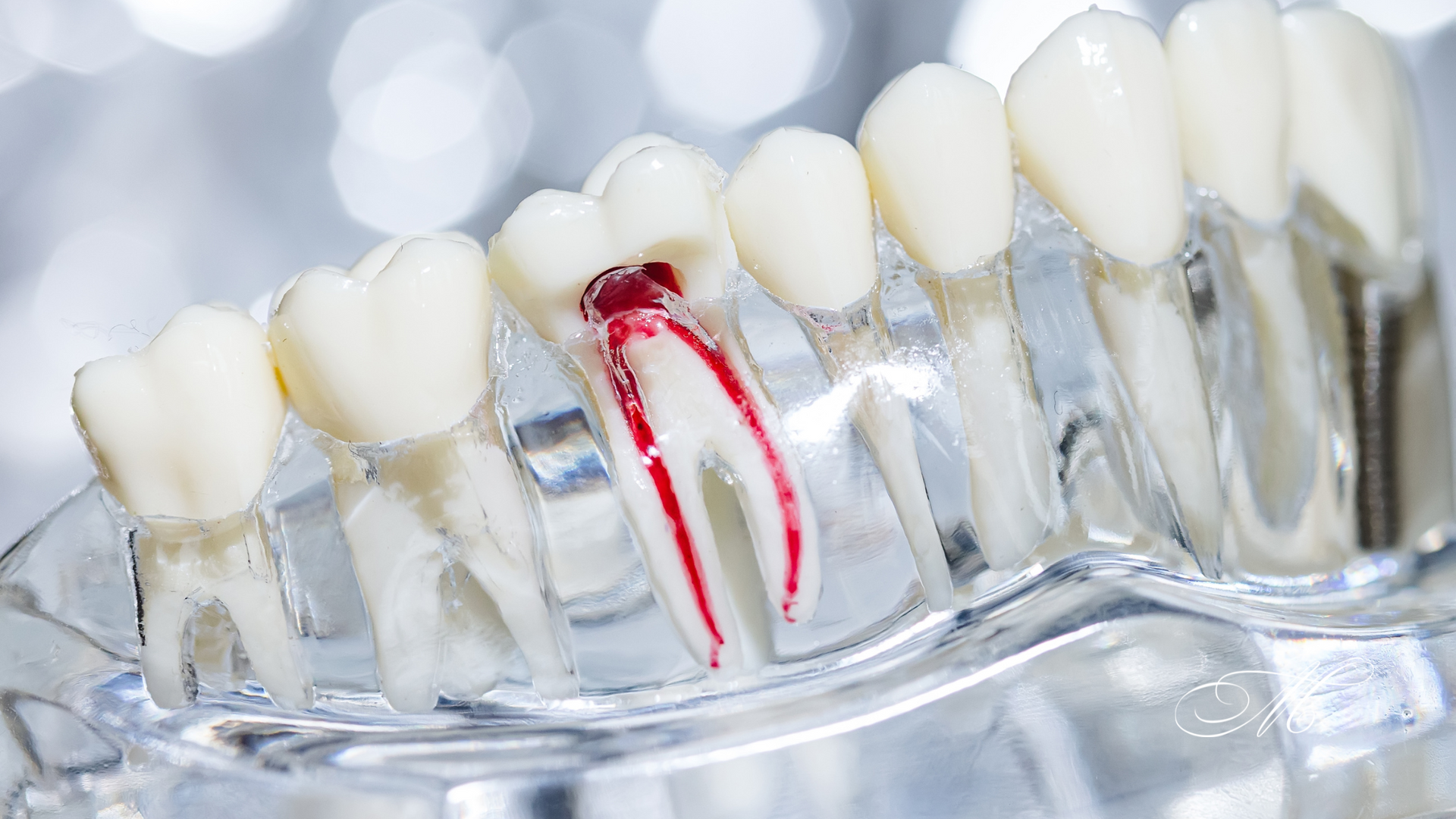 A close up of a model of teeth with a root canal.