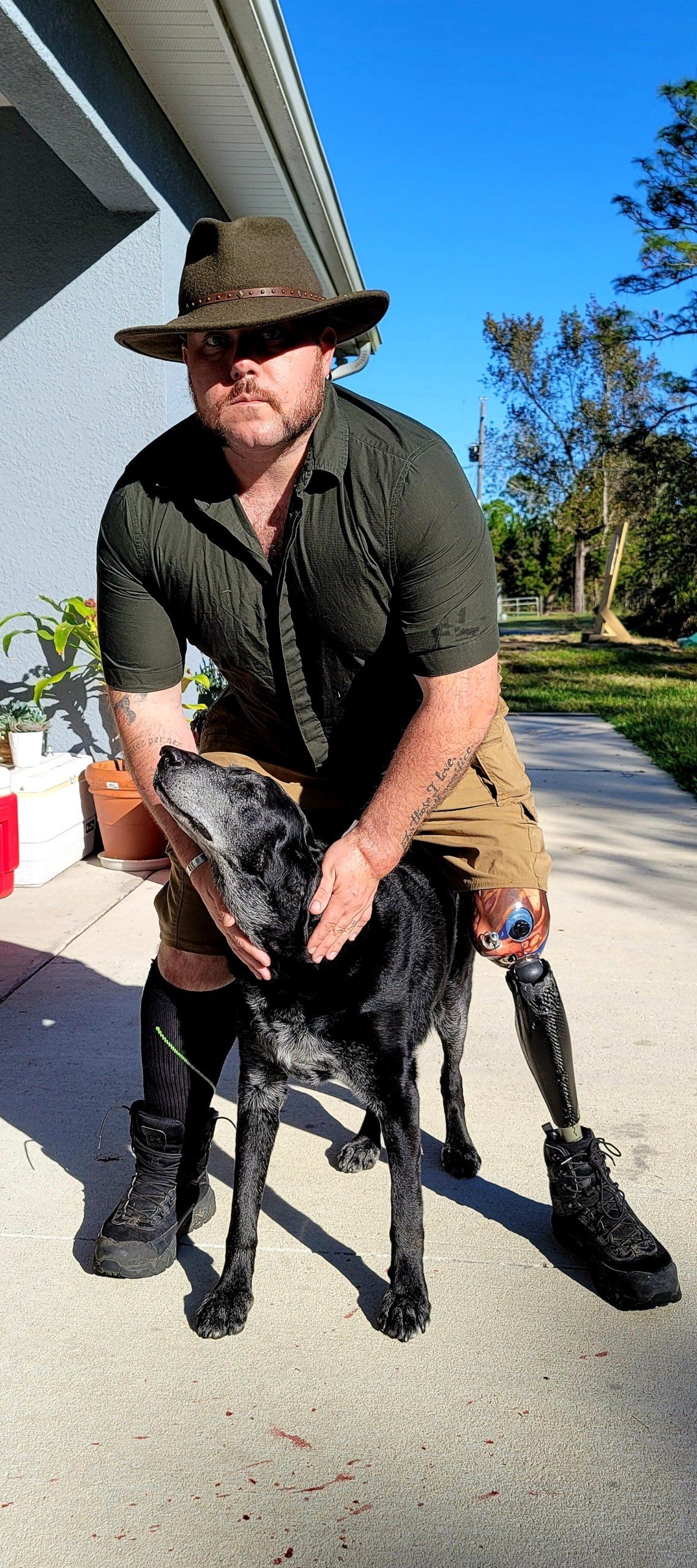 A man with a prosthetic leg is kneeling down next to a dog.