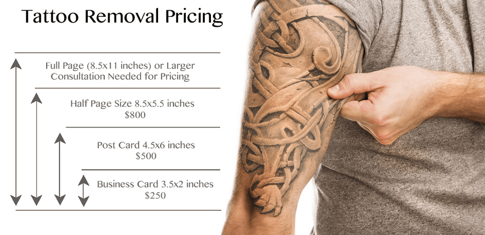 Dr. Desjarlais tattoo removal pricing chart.
