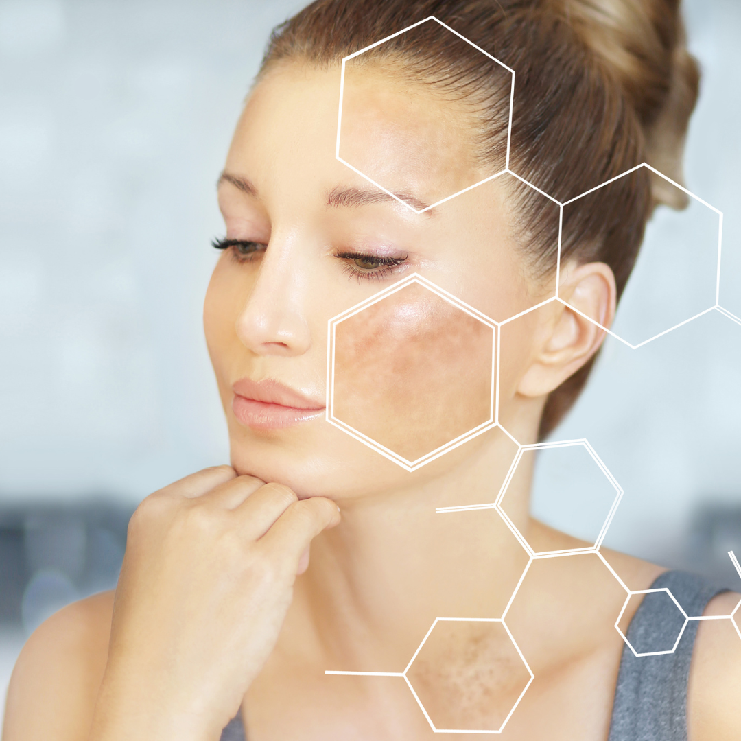 At Desjarlais Dermatology & Aesthetic Center we understand the emotional and physical impact of mela
