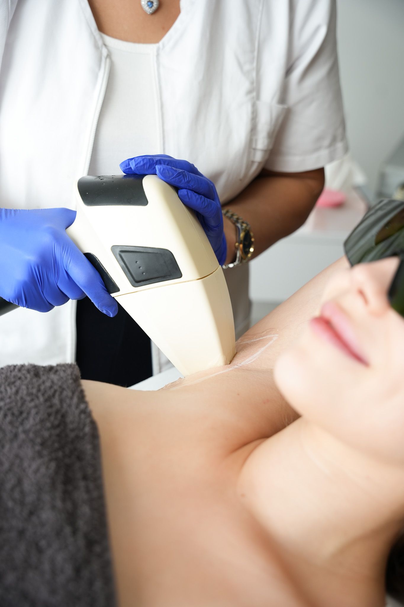 Eine Frau unterzieht sich einer Laserhaarentfernung an der Achselhöhle; eine Technikerin mit Handschuhen hält das Gerät.