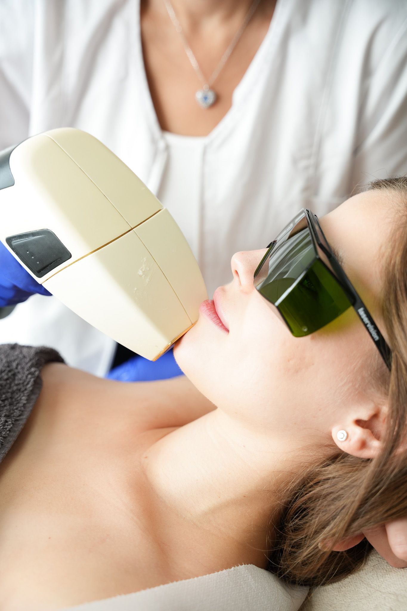 Eine Frau, die in einer Klinik eine Laserhaarentfernung am Kinn erhält und dabei eine Schutzbrille trägt.