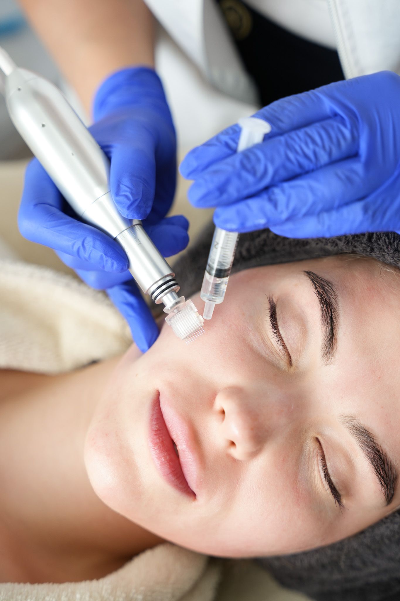 Frau bei einer Gesichtsbehandlung mit einem Microneedling-Gerät. Blaue Handschuhe, Augen geschlossen.