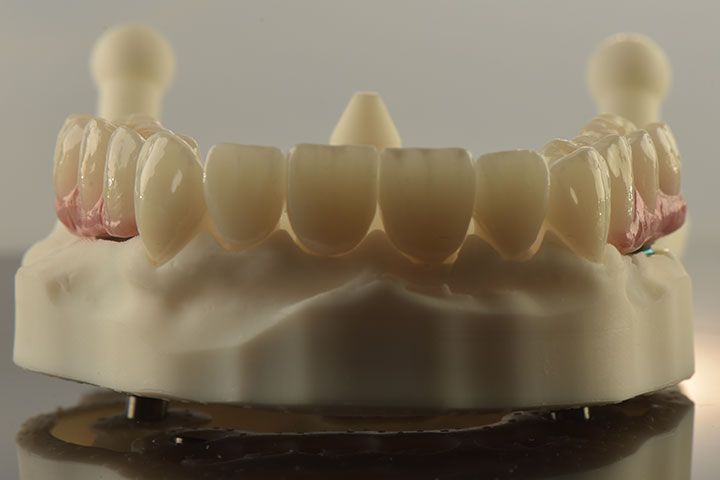 CLÍNICA MG IMPLANTES DENTALES